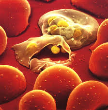 external image Malaria.jpg