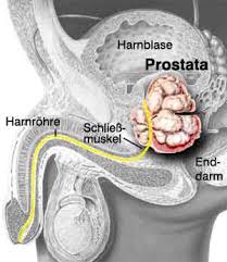 Foto di prostata - de