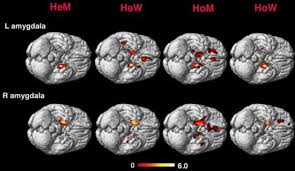 A scientist with a brain scanner ...