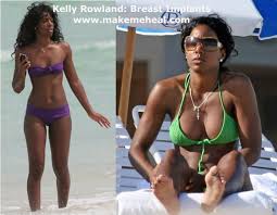 Kelly Rowland picture:kelly-rowland-breast-implants.jpg